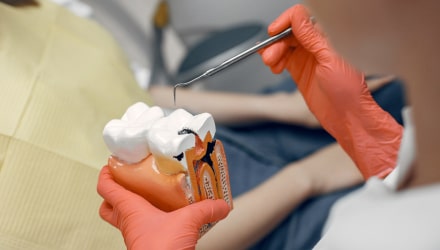 Endodoncia